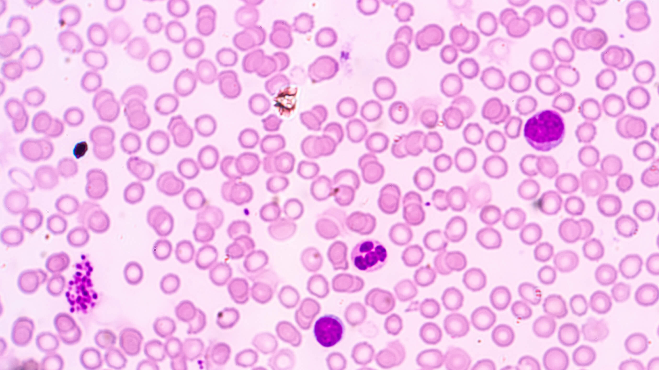 Haematology